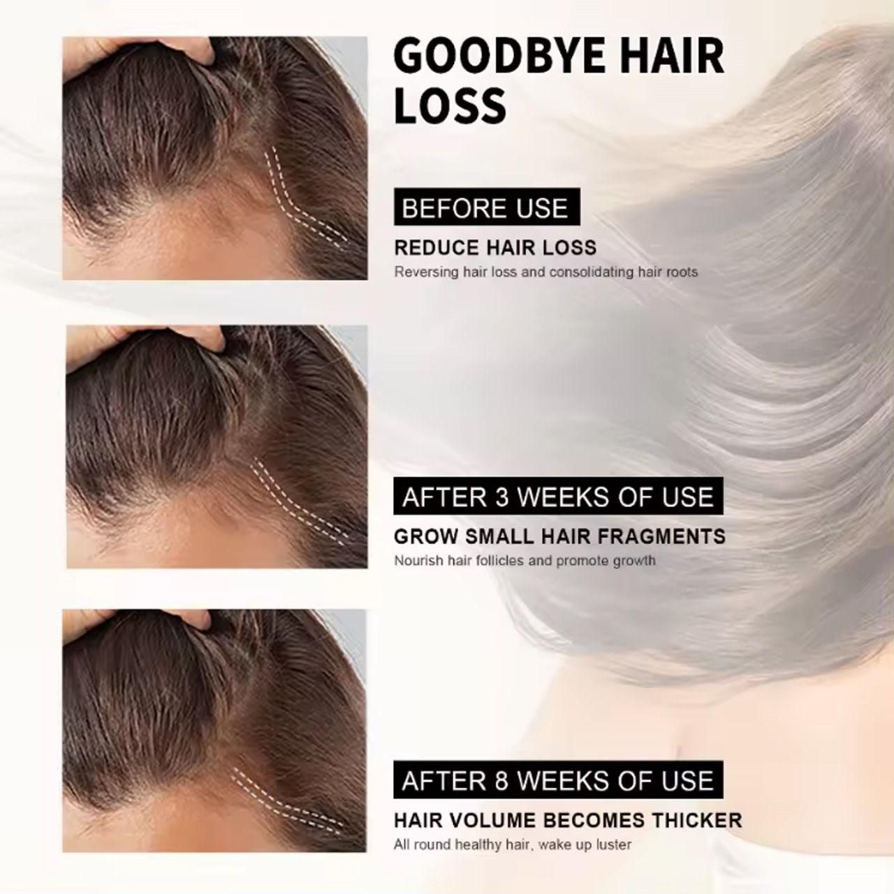 hair loss treatment serum 30ml (pack of 1)