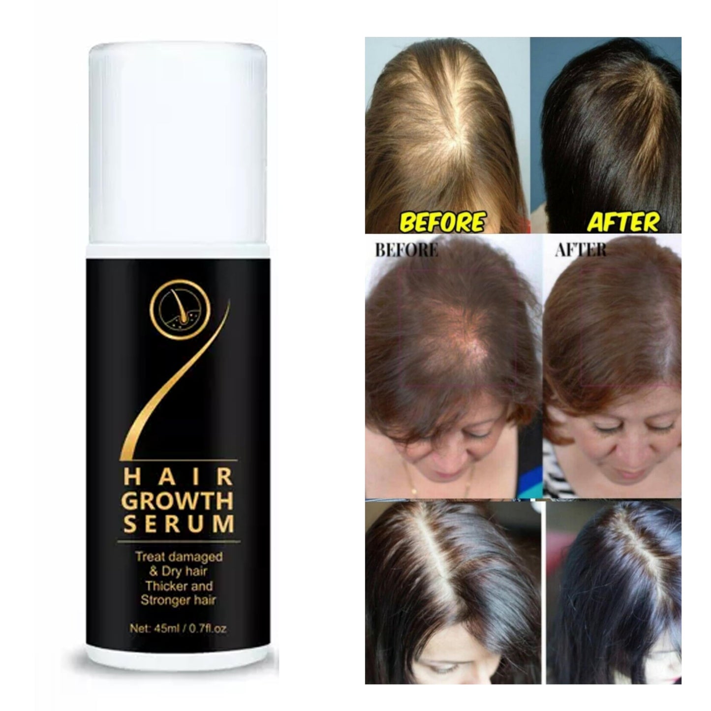 Hair Growth SERUM 45ml