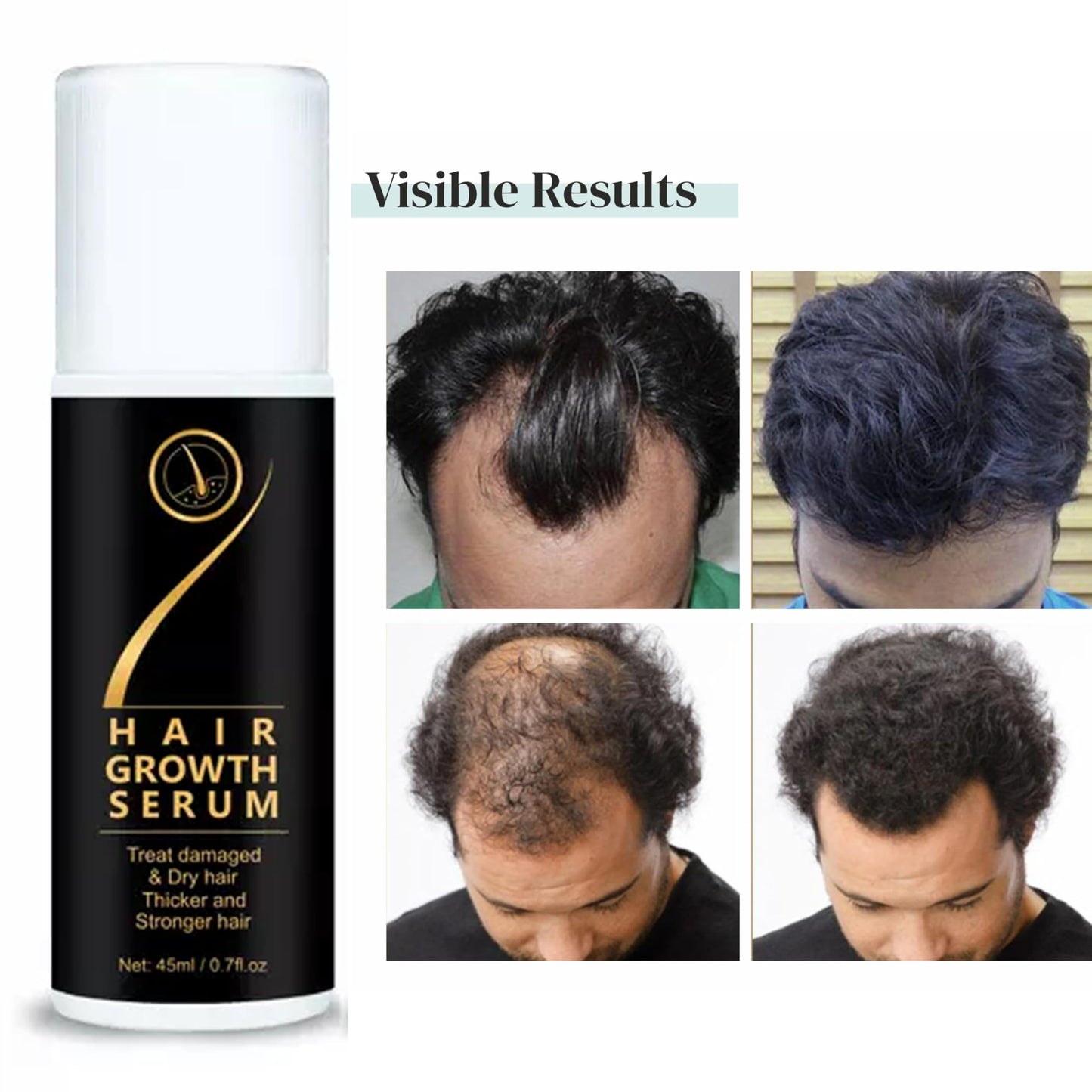 Hair Growth SERUM 45ml
