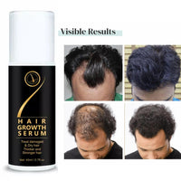 Hair Growth SERUM 45ml